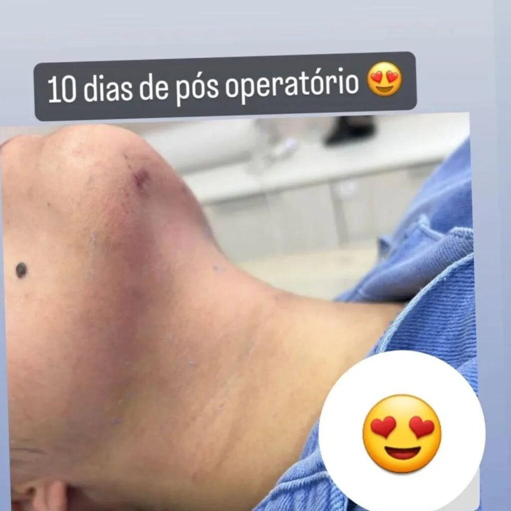 Instagram post from guilherme.rosetti. This post is in position 2.