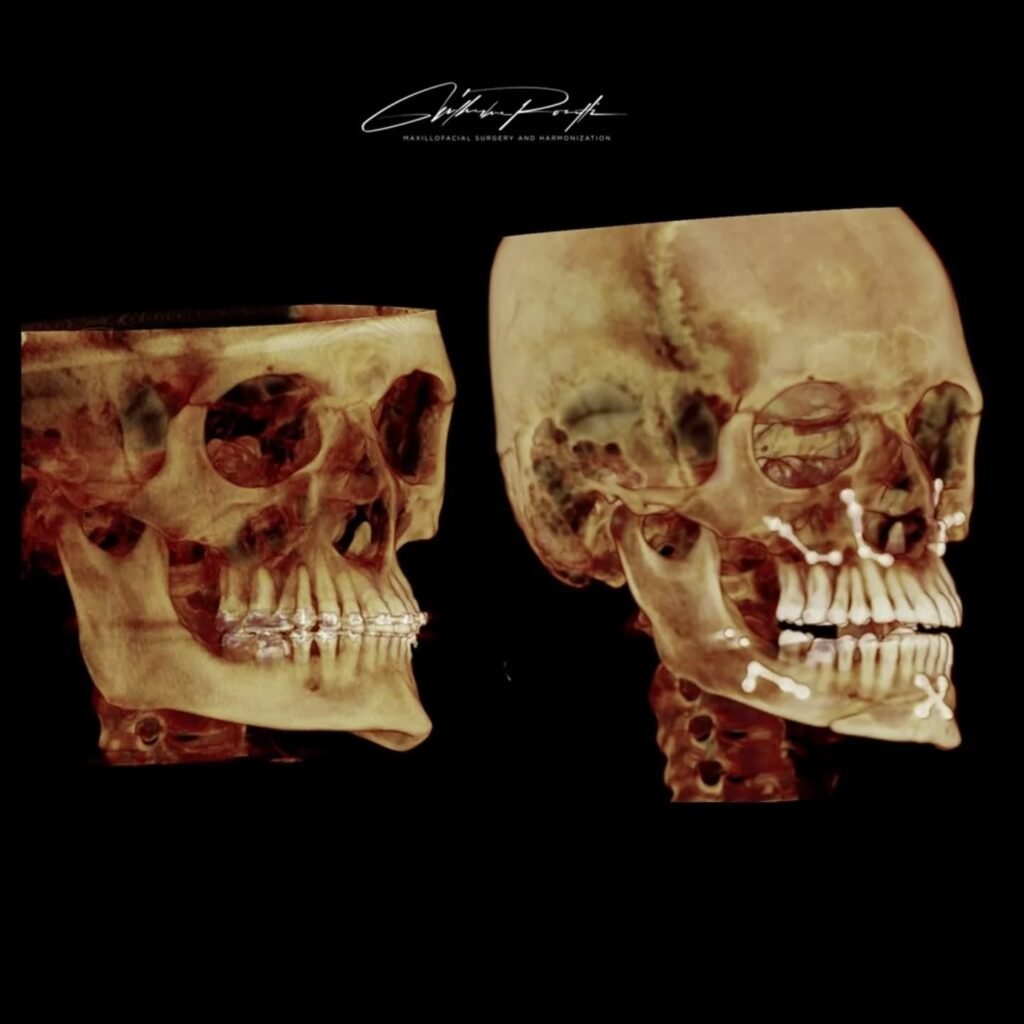 Instagram post from guilherme.rosetti. This post is in position 2.