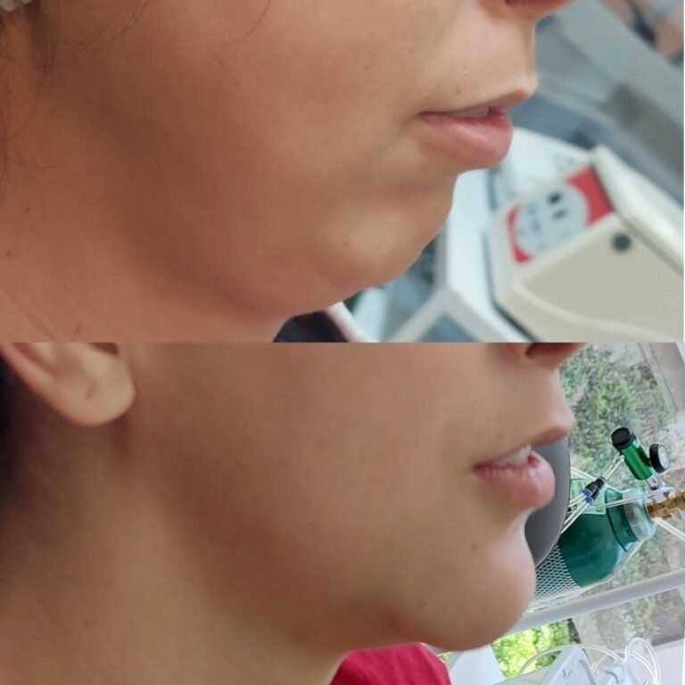 Instagram post from guilherme.rosetti. This post is in position 1.