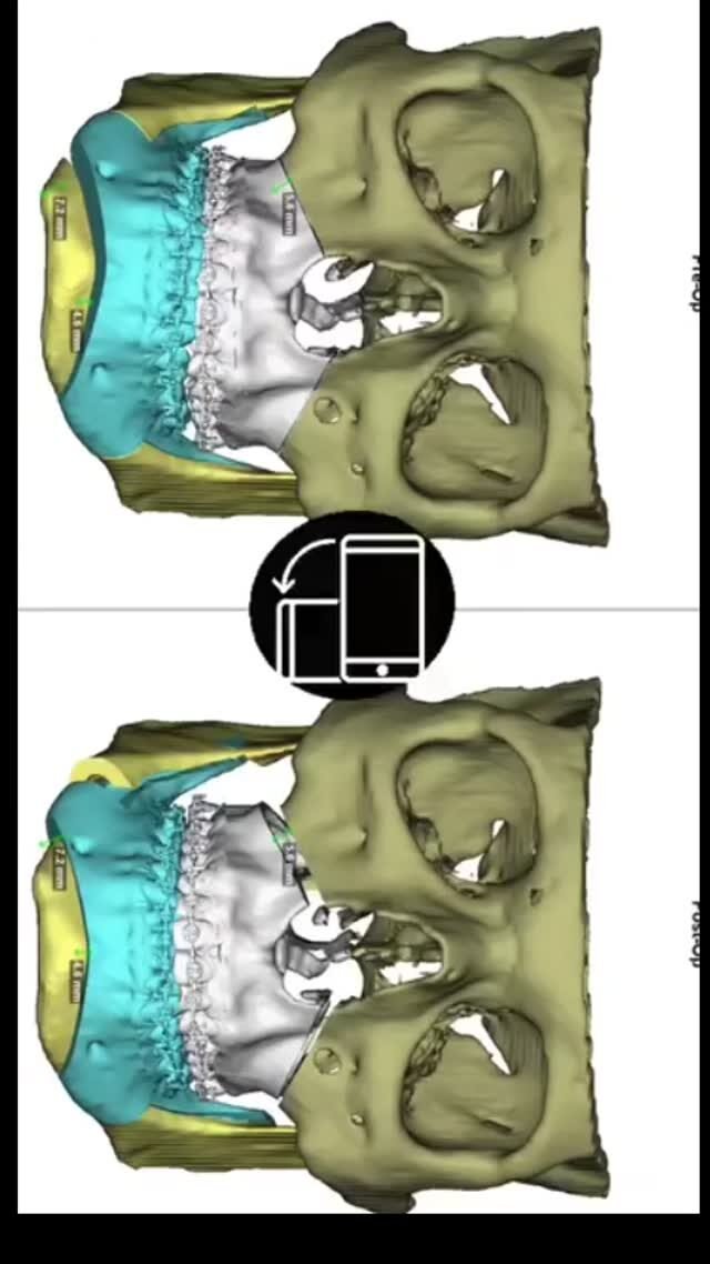 Instagram post from guilherme.rosetti. This post is in position 5.