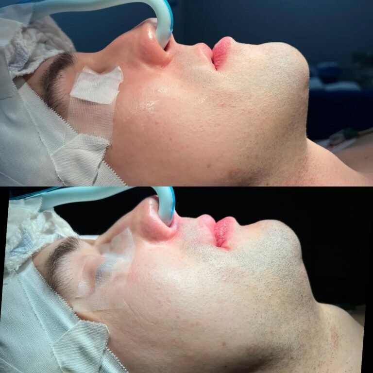 Instagram post from guilherme.rosetti. This post is in position 5.