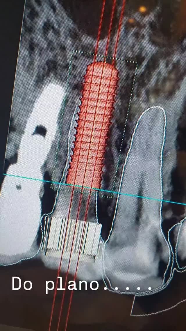 Instagram post from guilherme.rosetti. This post is in position 3.