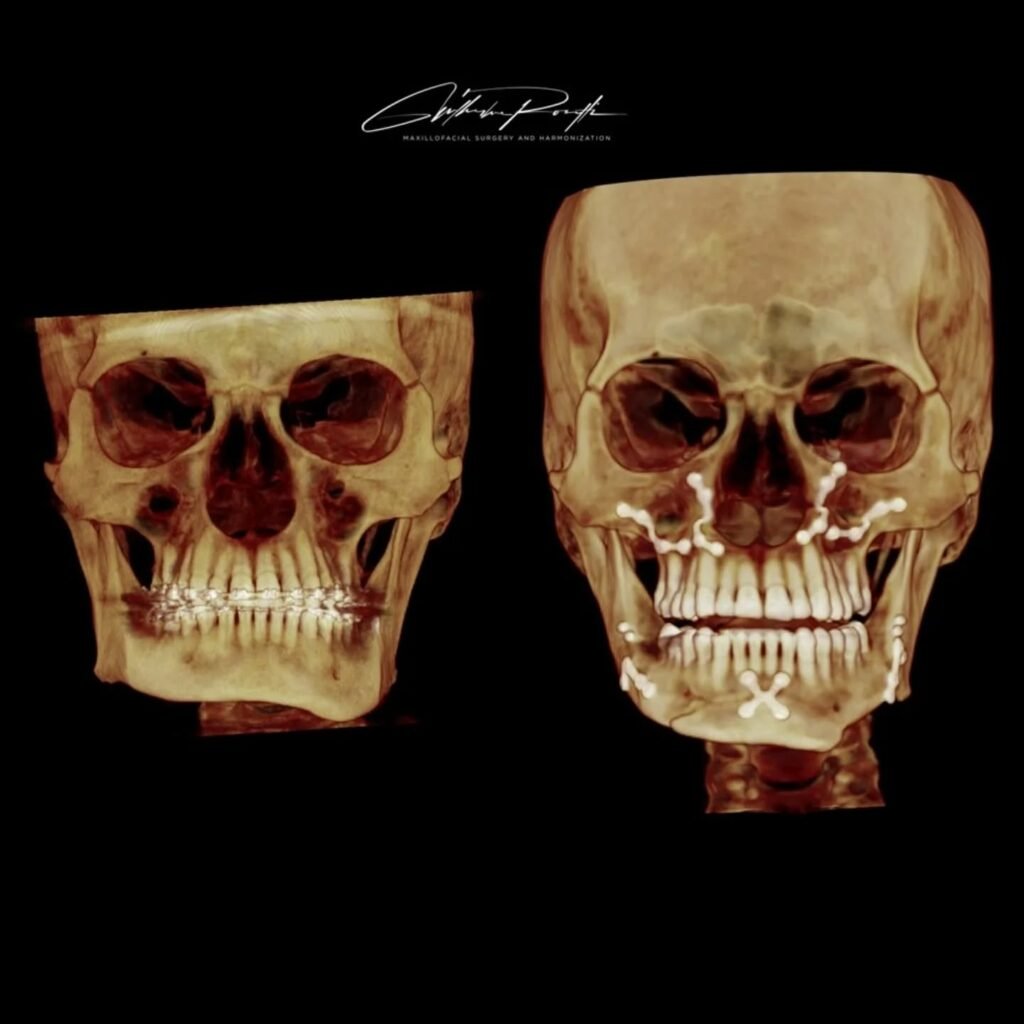 Instagram post from guilherme.rosetti. This post is in position 0.